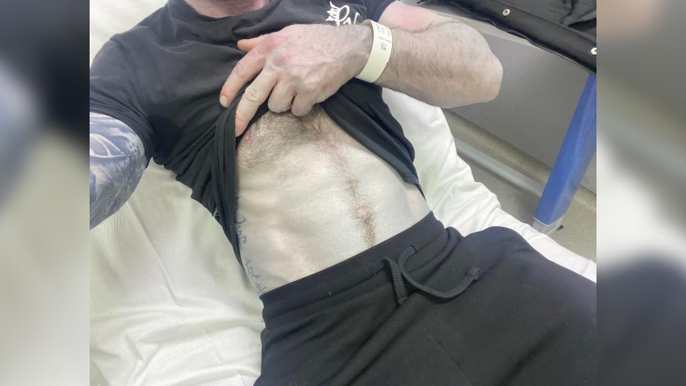 Dorso de Tommy também ficou com aspecto azulado depois da primeira noite com o edredom novo — Foto: Reprodução/Facebook