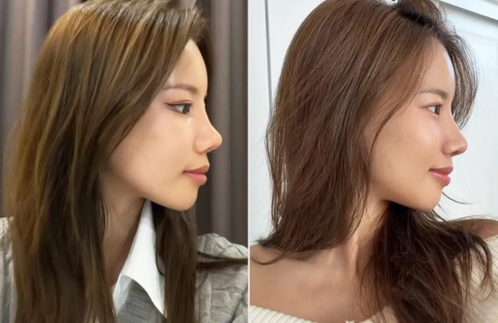 Charlene ap&oacute;s a primeira rinoplastia (&agrave; esquerda) e depois da segunda cirurgia &mdash; Foto: Reprodu&ccedil;&atilde;o