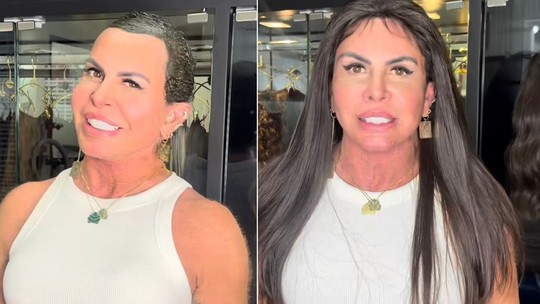 Gretchen revela cabelo natural em tratamento contra alopecia e adota peruca: 'Precisamos quebrar o preconceito'