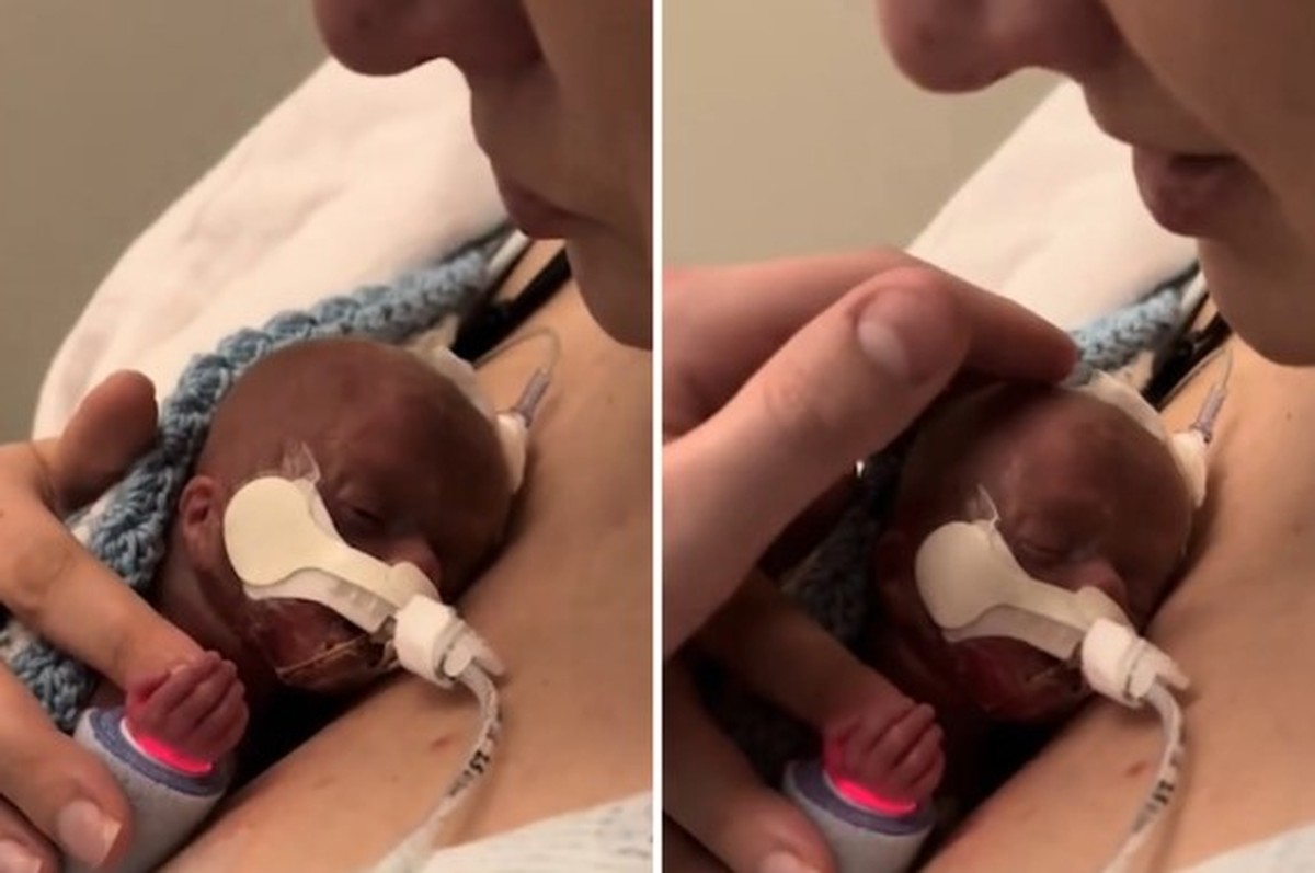 Bebê Prematuro Desafia as Chances: Mãe se Despede, Mas o Milagre Acontece!