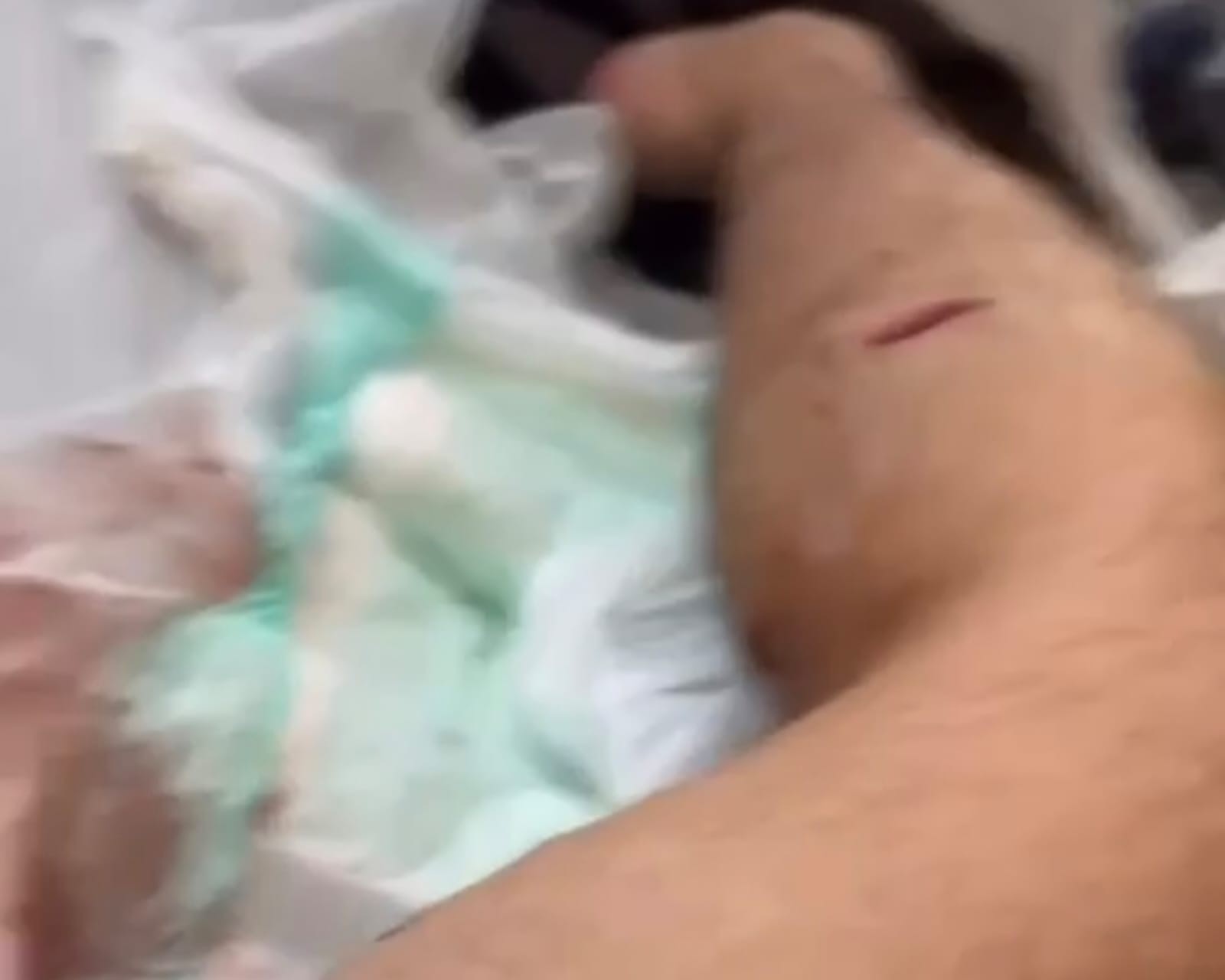 Canadense esfaqueado e extorquido no Rio segue internado; suspeito é homem belga