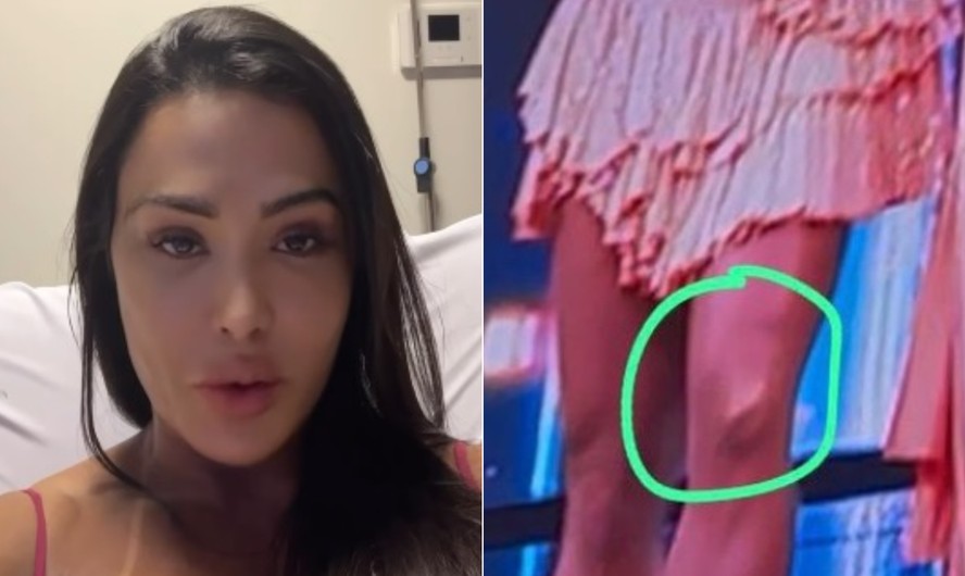 Gracyanne Barbosa se emociona ao falar sobre saída do 'Dança dos famosos' e lesão
