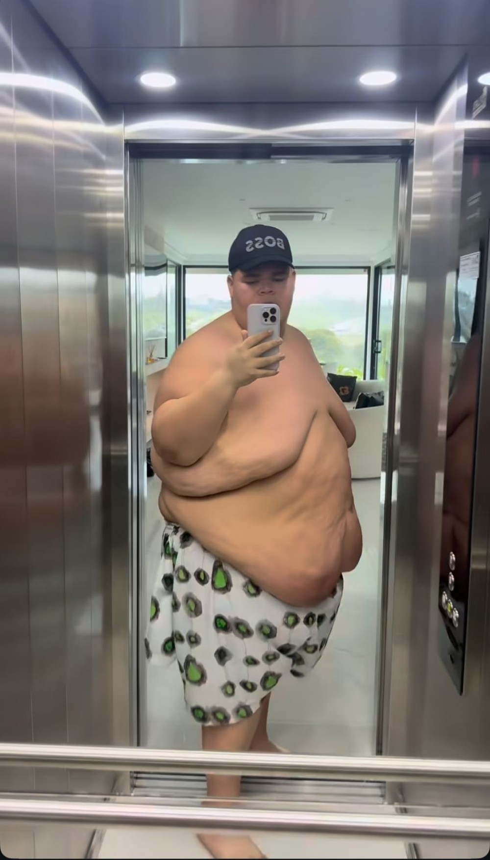 contioutra.com - De 349kg para 250kg: Após perder peso drasticamente, Gordão da XJ passa mal e revela detalhes do susto no hospital