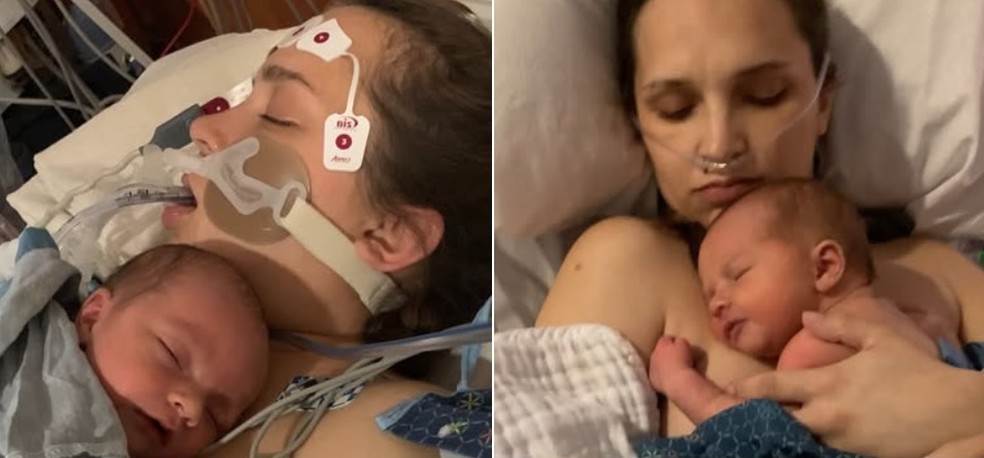Archer sobre o peito de Casey ainda inconsciente (à esquerda) e depois de ela sair do coma — Foto: Reprodução/Instagram