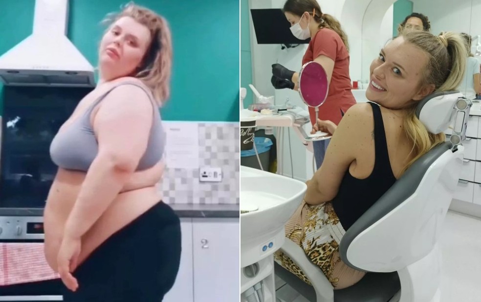 Lauren Evens antes e depois da transformação — Foto: Reprodução