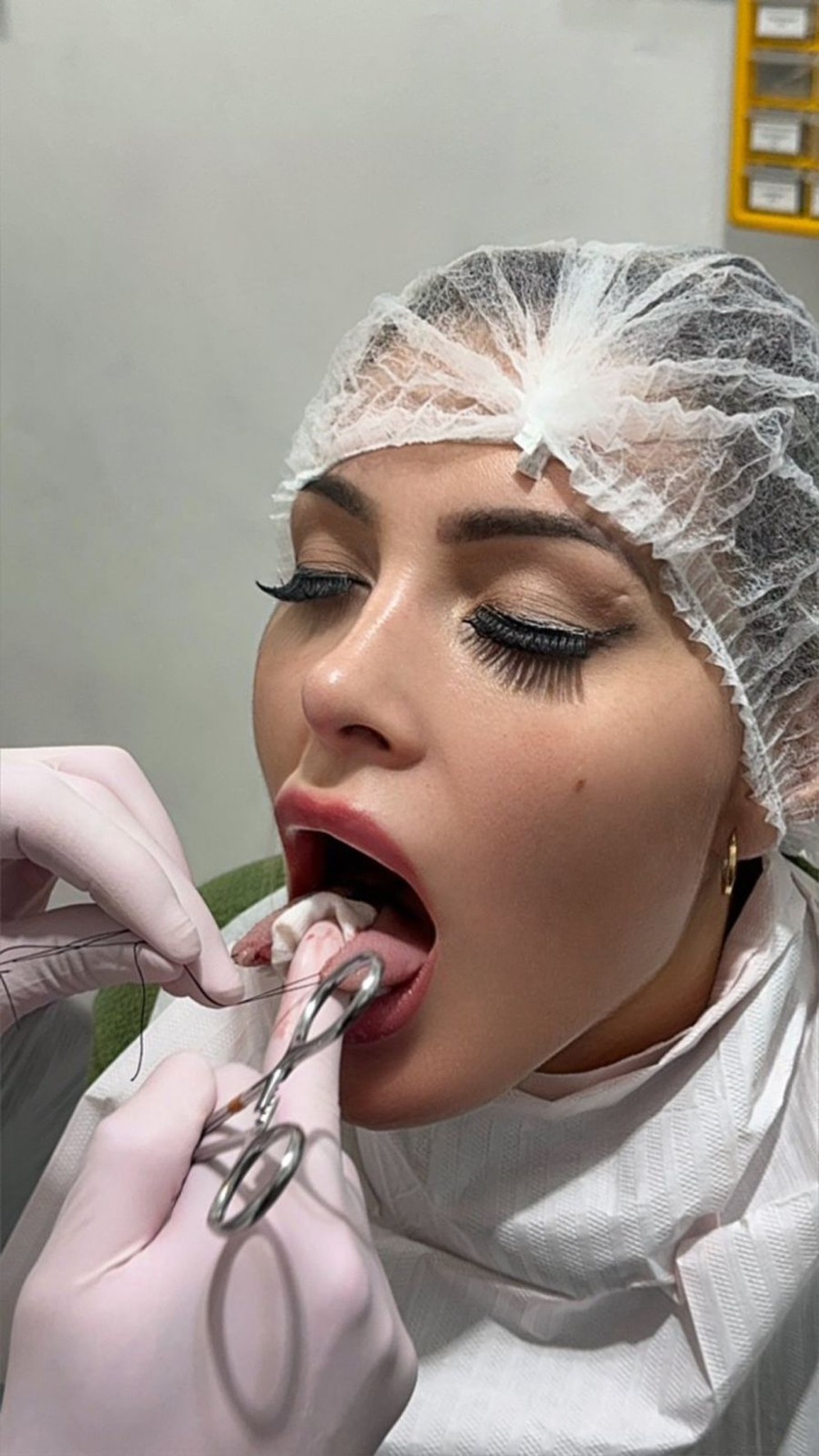 Imagens fortes: Andressa Urach faz procedimento de 'língua de cobra' em busca de 'maior prazer