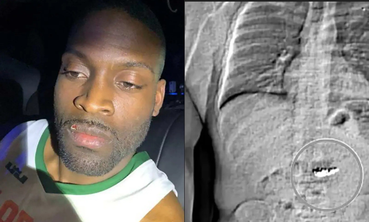 Homem é condenado após engolir jóias roubadas avaliadas em R$4 milhões - Foto