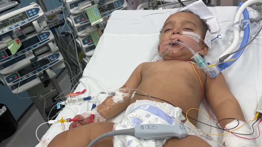 Bebê ingere soda cáustica após confundir garrafa com mamadeira: pai ...