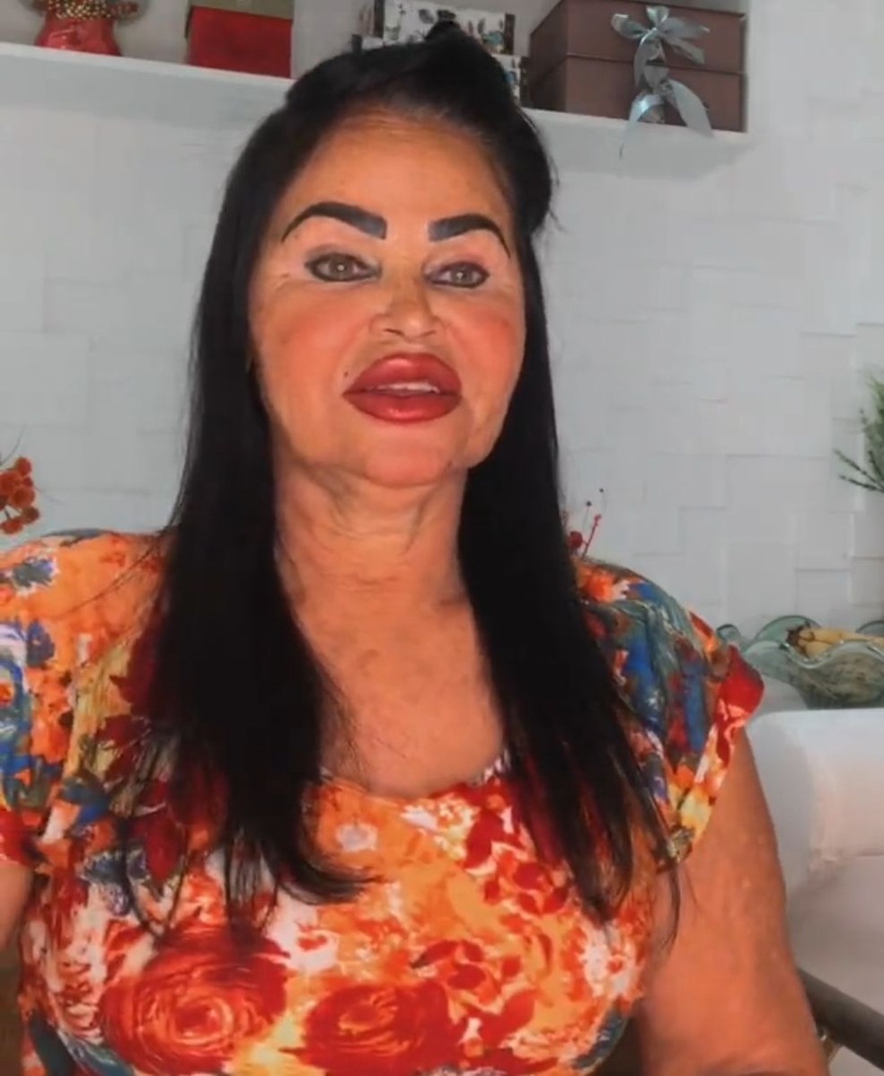 Mãe de Eduardo Costa nega harmonização facial — Foto: Instagram