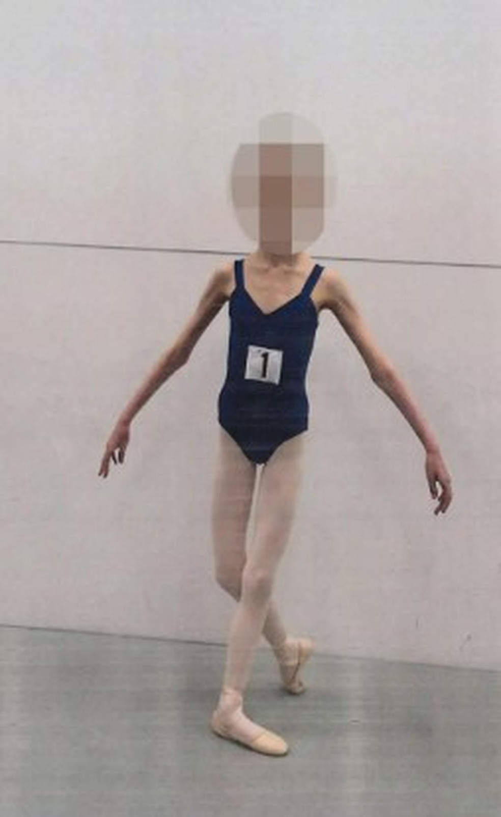 Pais s&atilde;o condenados na Austr&aacute;lia por deixar filha bailarina chegar a pesar 27 quilos &mdash; Foto: Reprodu&ccedil;&atilde;o/District Court of Western Australia