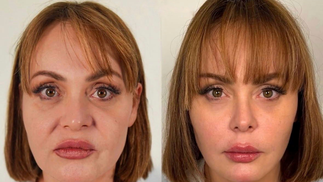 Gaby Spanic, a Usurpadora, mostra antes e depois de rejuvenescimento facial — Foto: Reprodução/Instagram