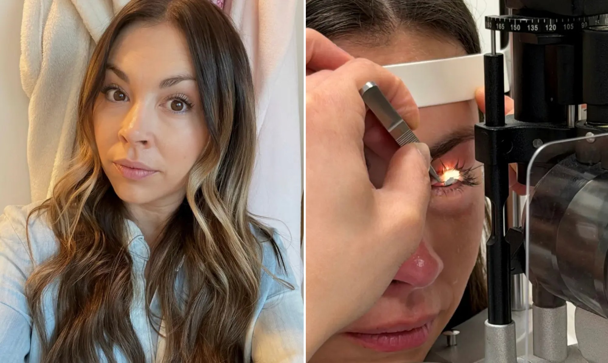 Mulher desenvolve doença ocular incurável por costume de dormir com maquiagem por anos - QTU Questões do Universo