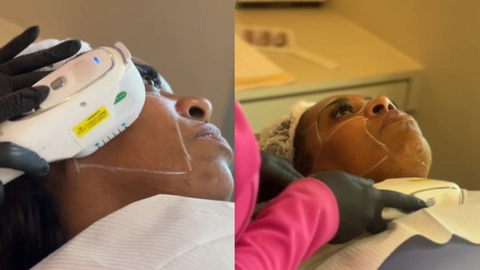 Mãe de Vini Jr. aposta em procedimentos estéticos para brilhar na Sapucaí ao lado de Virginia