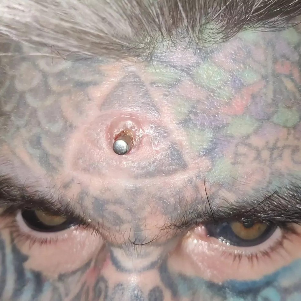 "O homem mais tatuado" contou aos fãs sobre seu implante transdérmico infectado — Foto: Reprodução/Instagram