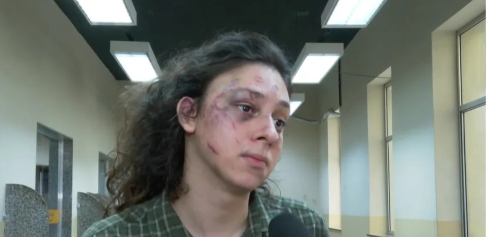 O ator e influenciador Victor Meyniel  prestou depoimento na delegacia após ser agredido — Foto: Reprodução/Agência o Globo