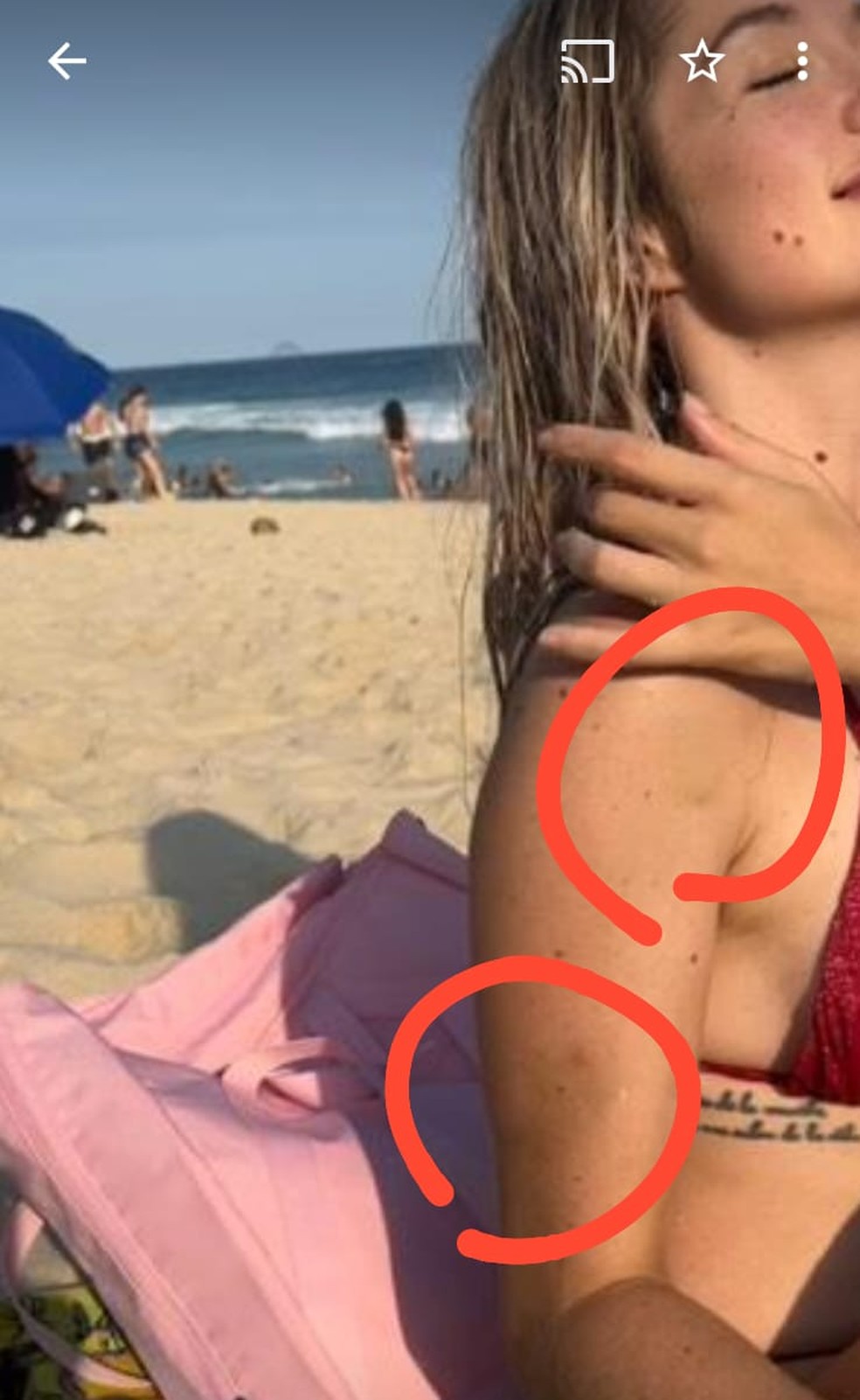 Advogada Larissa Ferrari mostrou hematomas pelo corpo ao acusar Dimitri Payet, do Vasco, de agressão — Foto: Arquivo pessoal