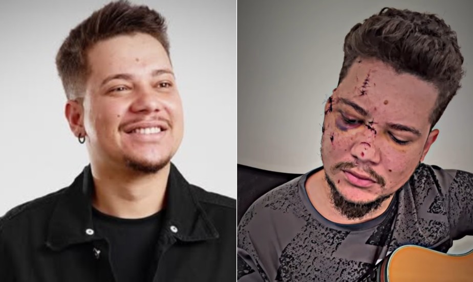 Sertanejo Bencio leva 32 pontos no rosto aps ser agredido com garrafa