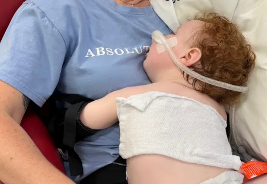Beb&ecirc; de 1 ano &eacute; colocado em coma ap&oacute;s inalar p&oacute; usado para decora&ccedil;&atilde;o de bolos