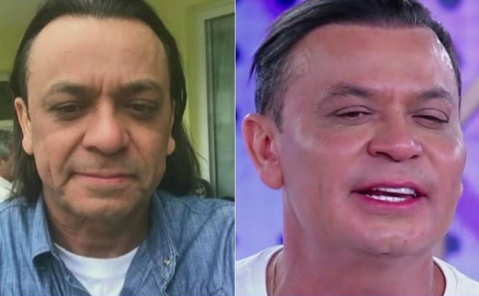 Frank Aguiar celebra harmonização facial e fim do cabelão  — Foto: Instagram