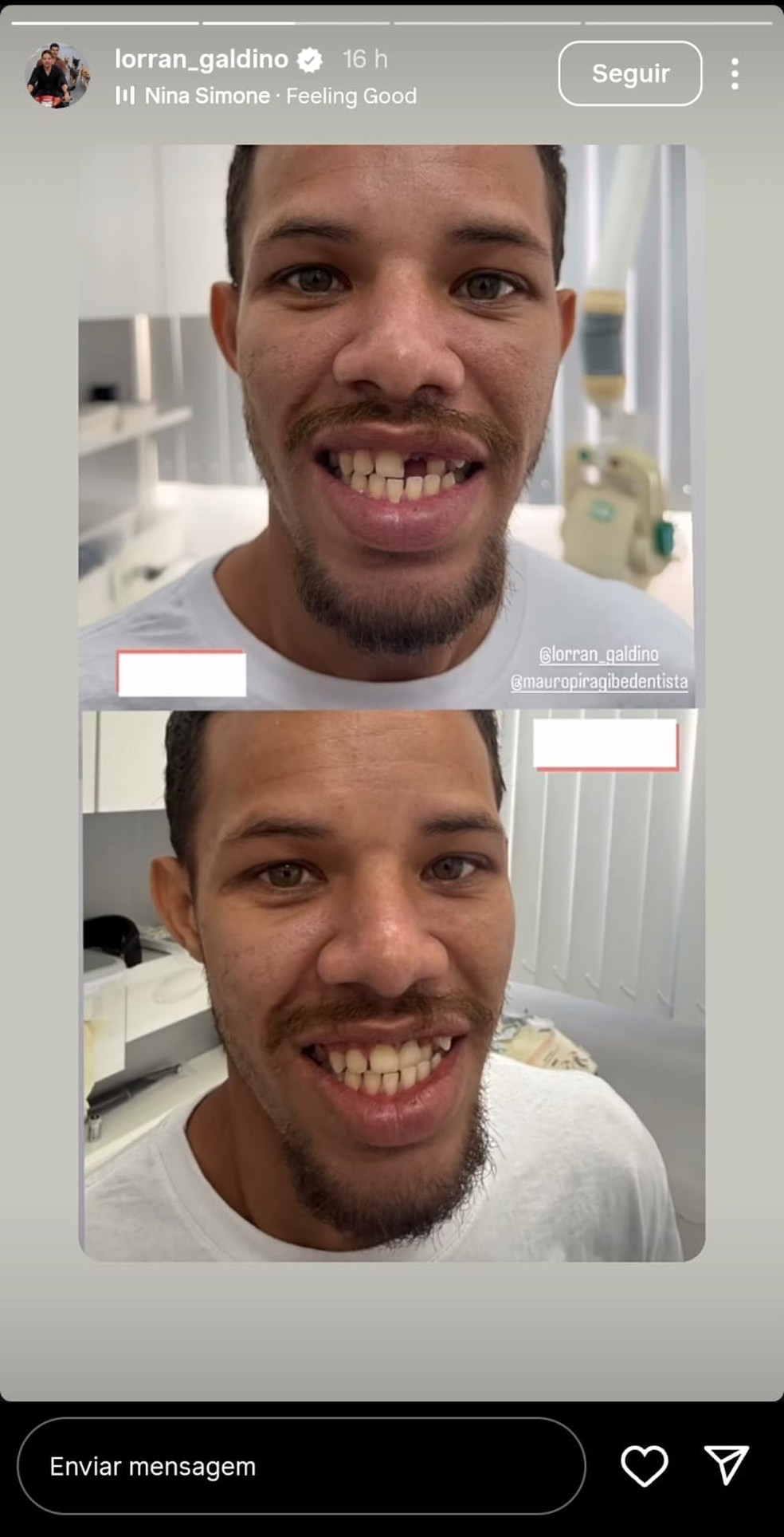 Ator José Loreto leva sósia ao dentista, e Lorran Galdino ganha novo sorriso; veja antes e depois — Foto: Instagram/reprodução