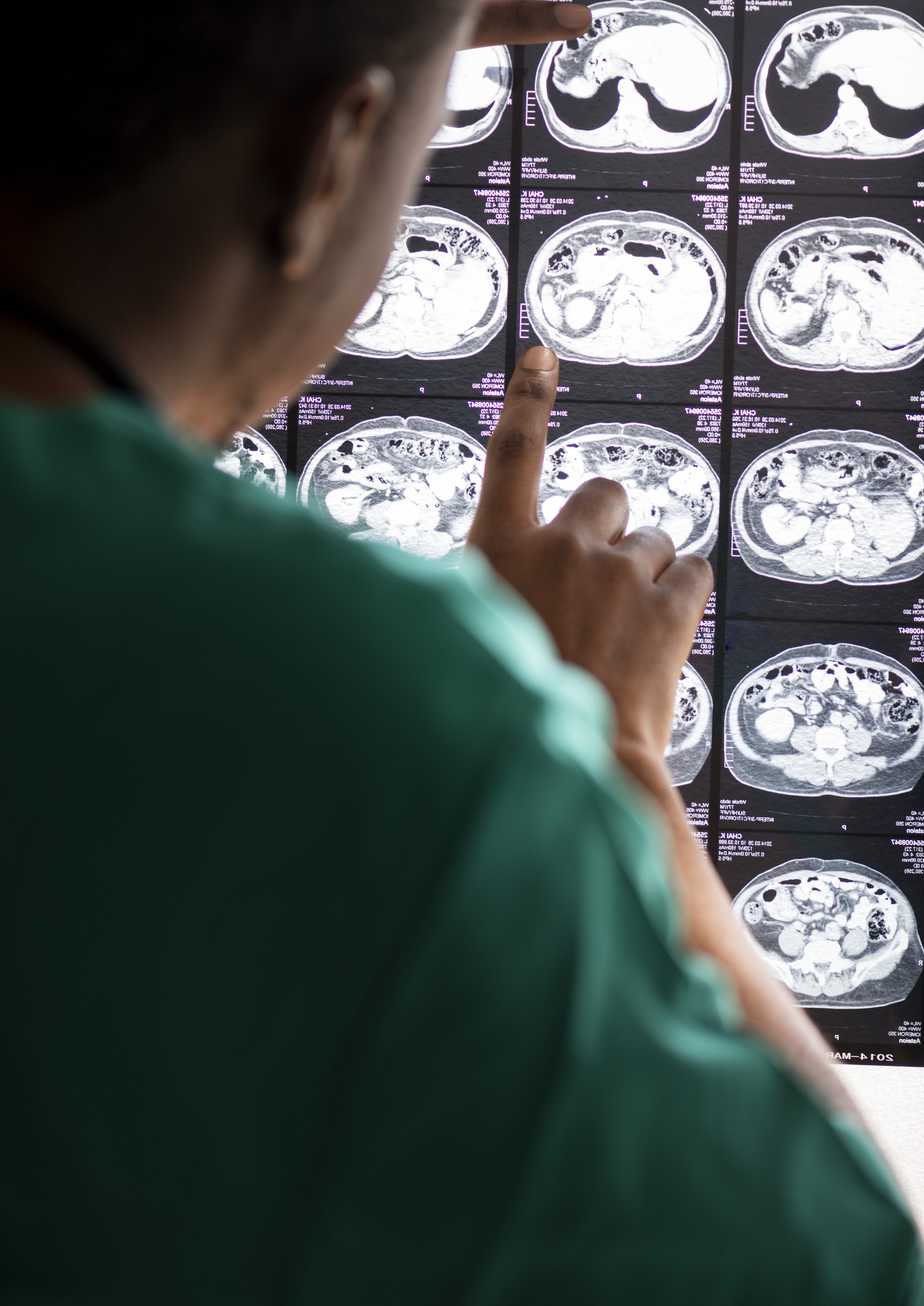 Fazer mais exames nem sempre significa prevenir melhor, alerta médico - QTU Questões do Universo