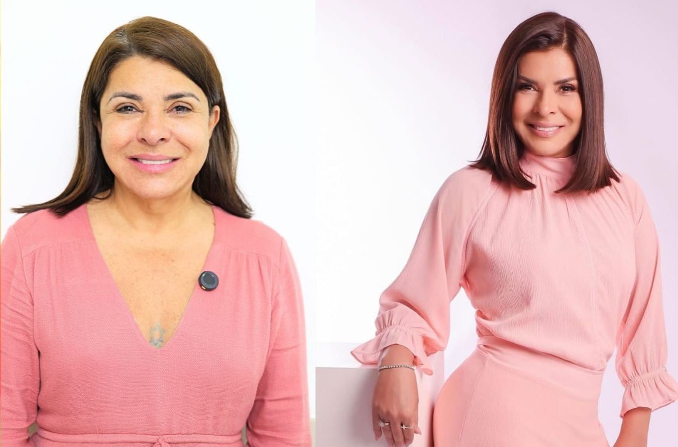 Mara Maravilha mostra resultado de Lift Facial Natural: 'Autoestima renovada'