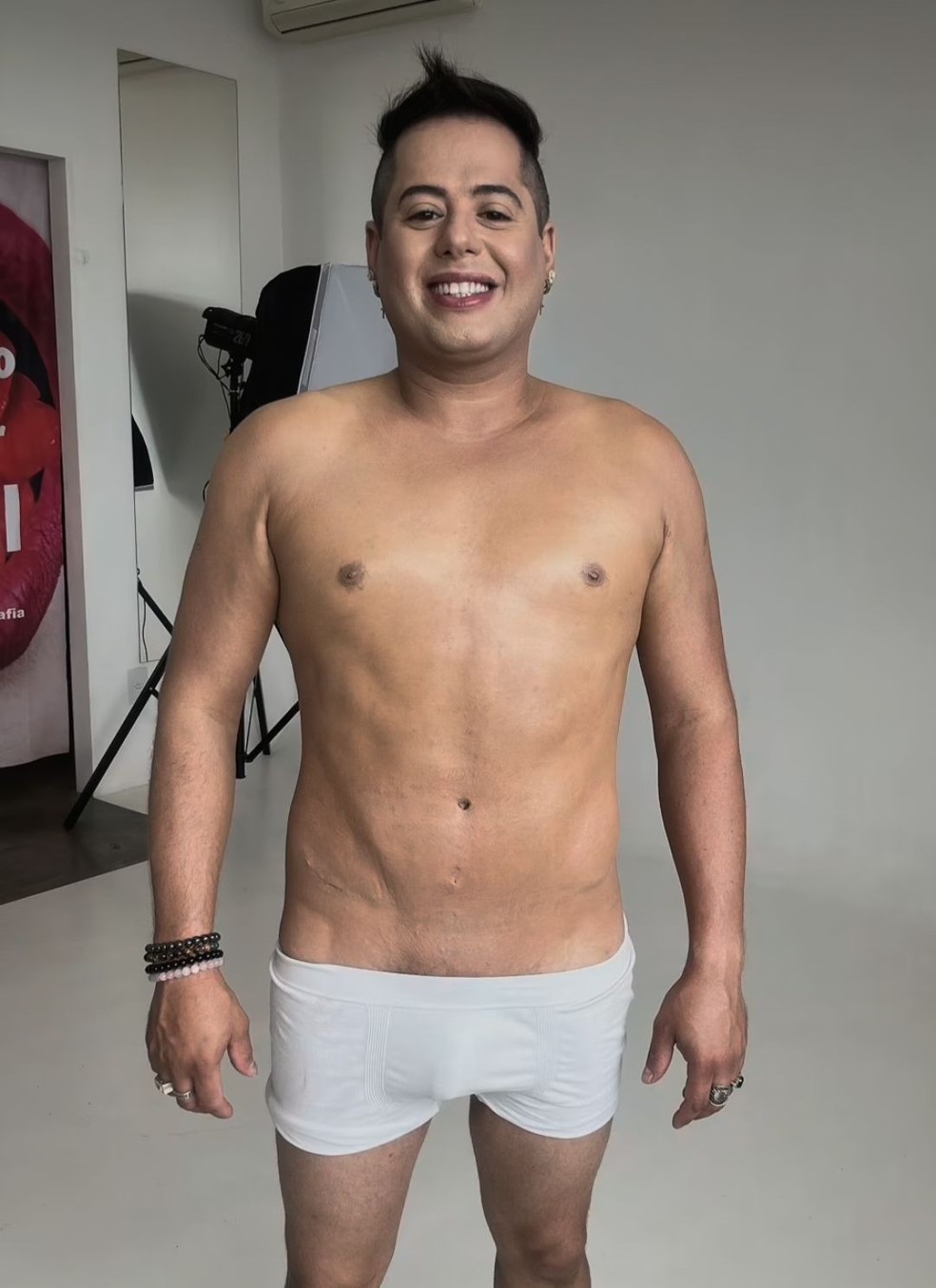 Sertanejo Hugo, da dupla com Tiago, exibe 'barriga chapada' após lipo — Foto: Instagram
