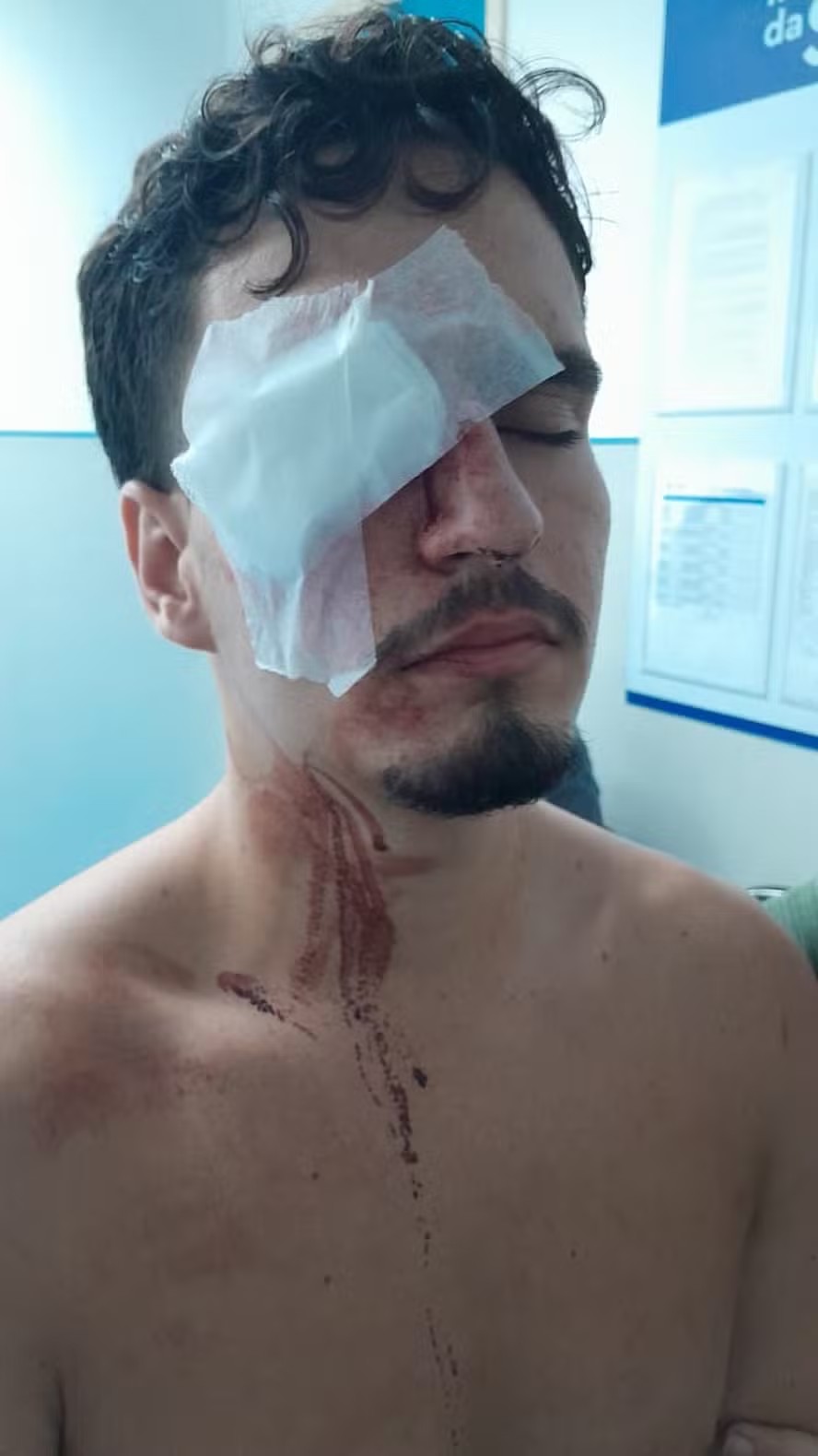Torcedor do Vasco é atingido por bala de borracha após clássico contra o Flamengo e corre risco de perder visão