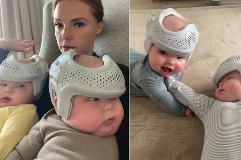 Gêmeos Nico e Ash usam capacete 23 horas por dia — Foto: Reprodução/TikTok