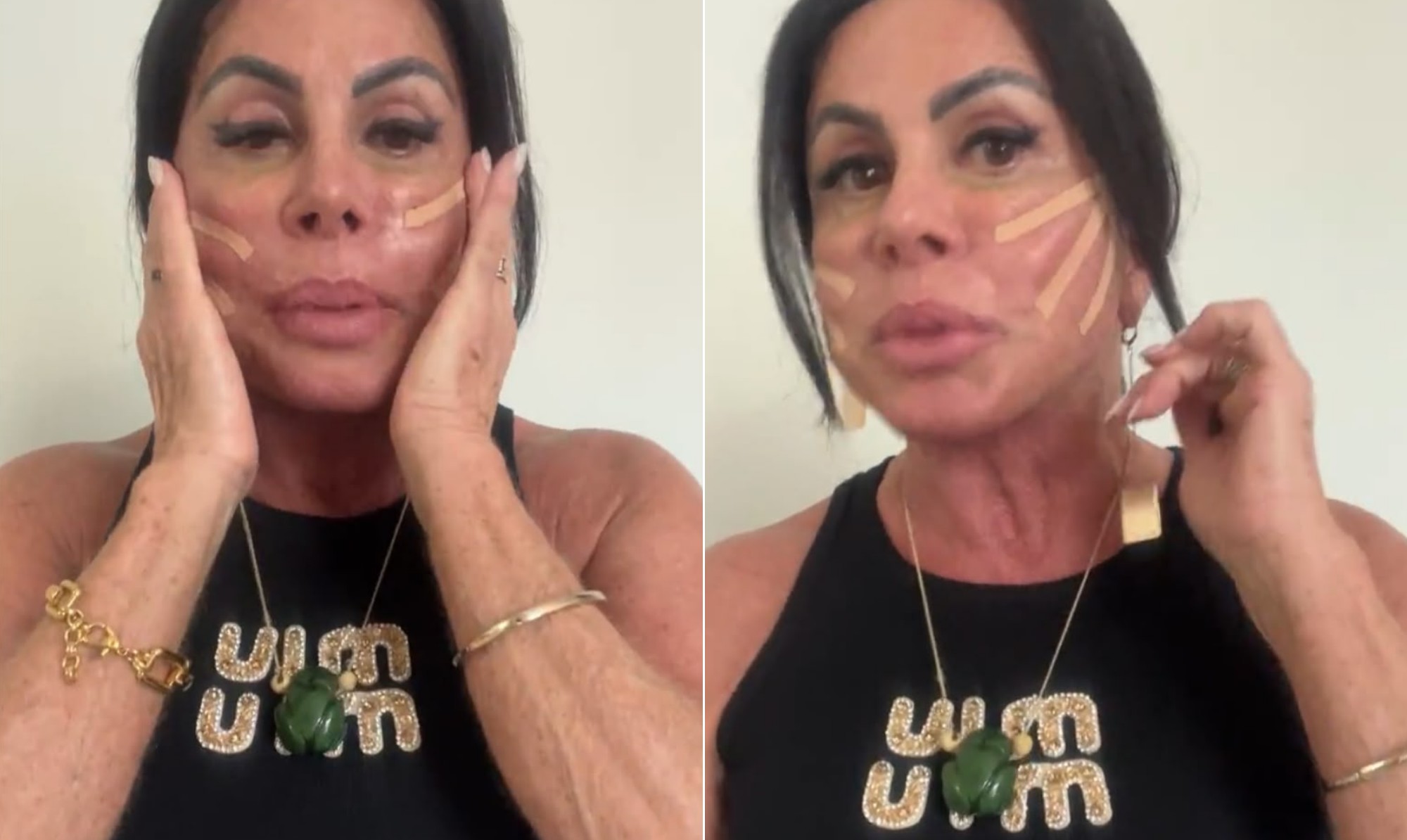 Gretchen mostra novos procedimentos estéticos