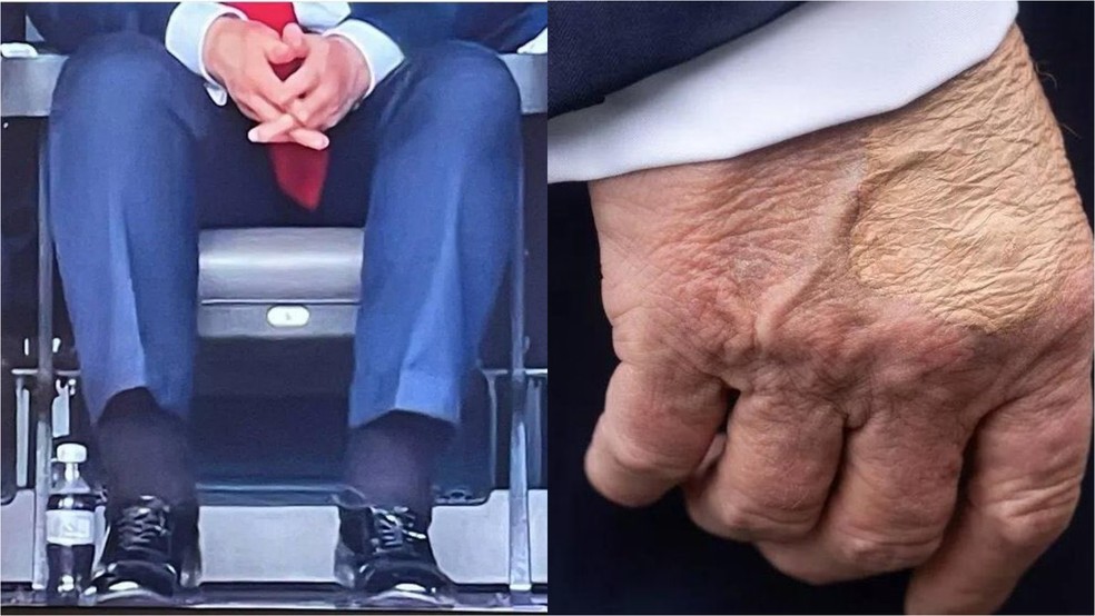 Sa&uacute;de de Donald Trump &eacute; alvo de questionamentos nas redes sociais &mdash; Foto: Reprodu&ccedil;&atilde;o/X