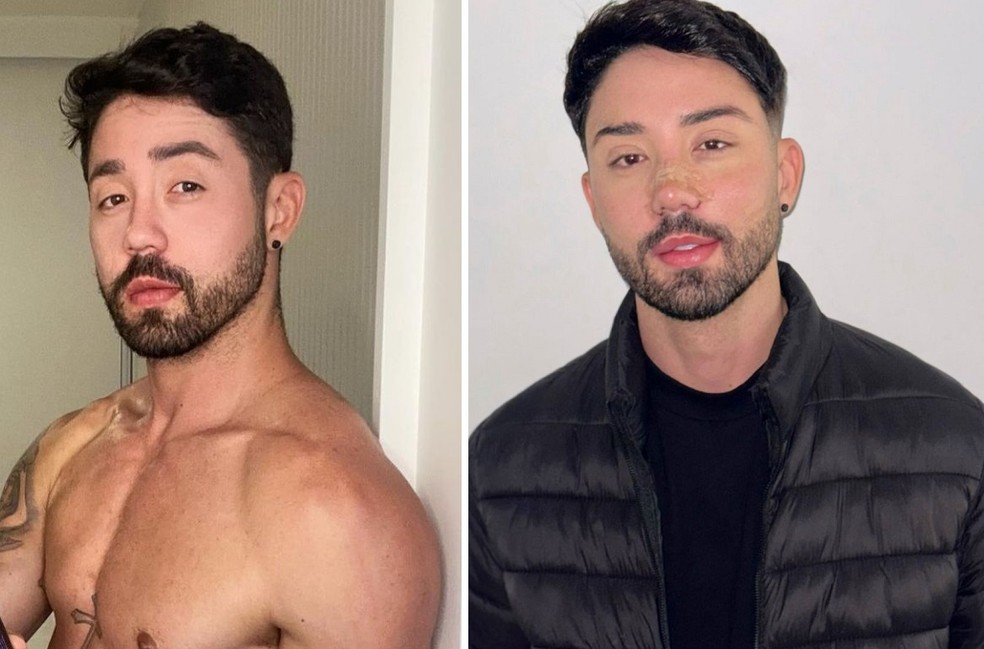 Rico Melquíades antes e depois da cirurgia — Foto: Instagram