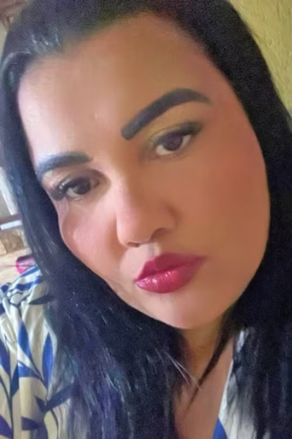 Priscila dos Santos Nascimento morreu ap&oacute;s um tratamento est&eacute;tico para varizes com o Dr. Armando Marins &mdash; Foto: Reprodu&ccedil;&atilde;o/TV Globo