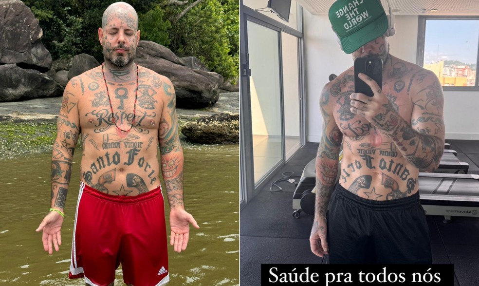 Tico Santa Cruz Antes E Depois
