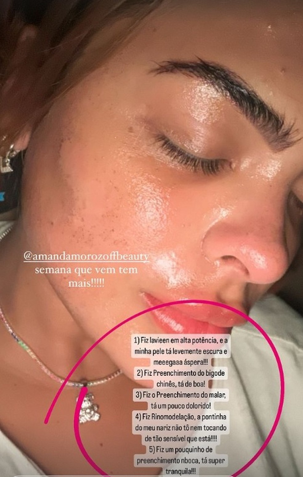 Ex-BBB Paula Freitas faz novos procedimentos após remodelamento de costela:  Semana que vem tem mais