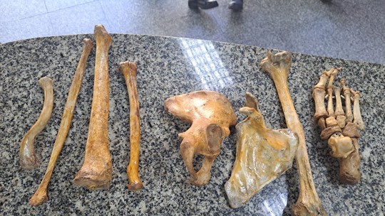 Homem é preso na Tijuca suspeito de vender ossos humanos