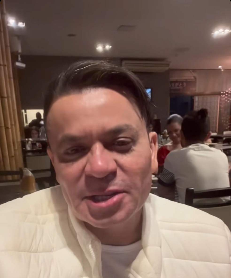 Frank Aguiar celebra harmonização facial e fim do cabelão  — Foto: Instagram